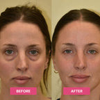 Revive Tired Eyes – Hydrating & Anti-Wrinkle Eye Balm
