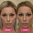 Revive Tired Eyes – Hydrating & Anti-Wrinkle Eye Balm